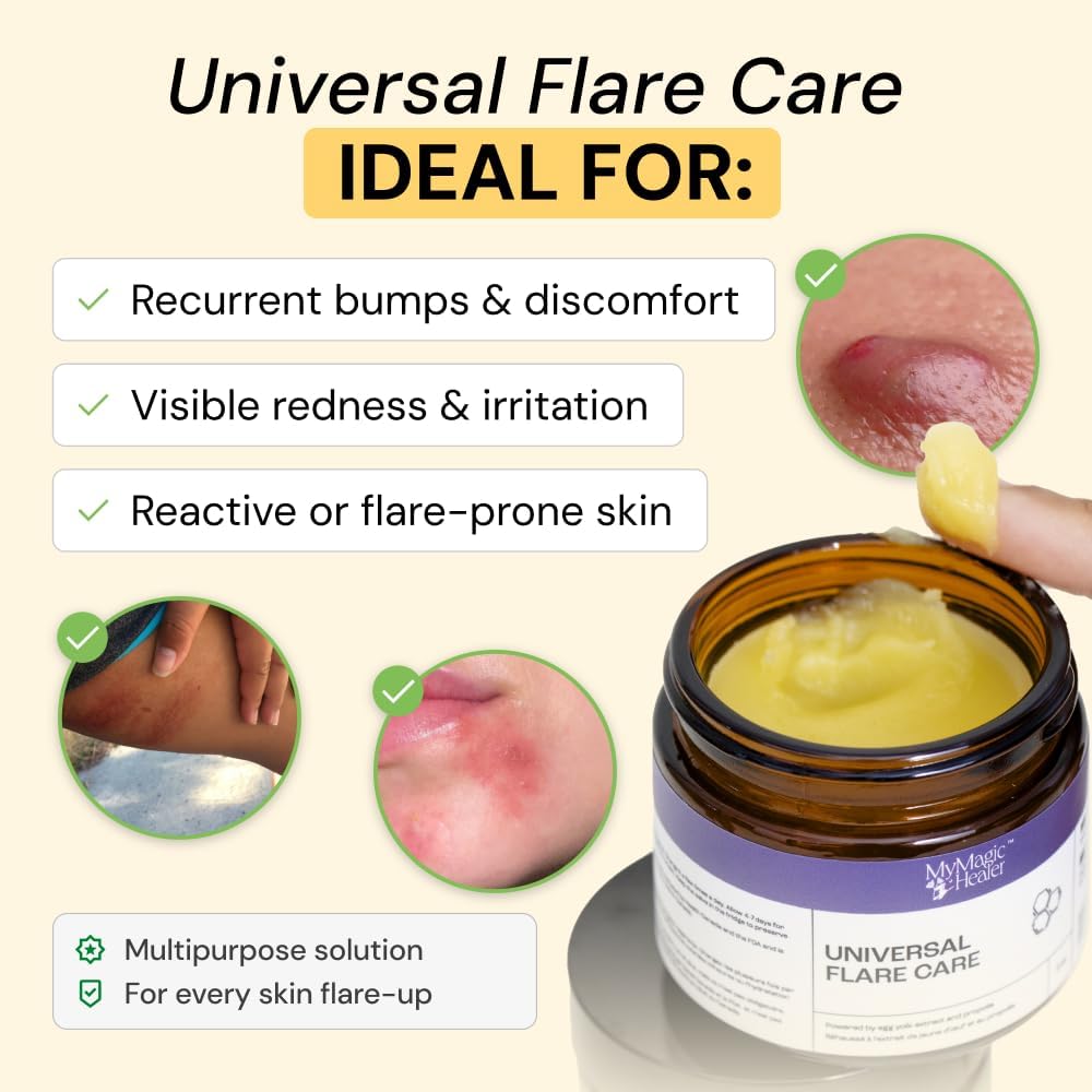 MyMagicHealer Universal Flare Care ‰ÛÒ Multi-Purpose Solution | Skin Flare-Ups - Hidradenitis Suppurativa, Folliculitis, Boils, Cysts | Anti-Chafing | Irritated Skin Relief w/Propolis & Egg Yolk 1 oz