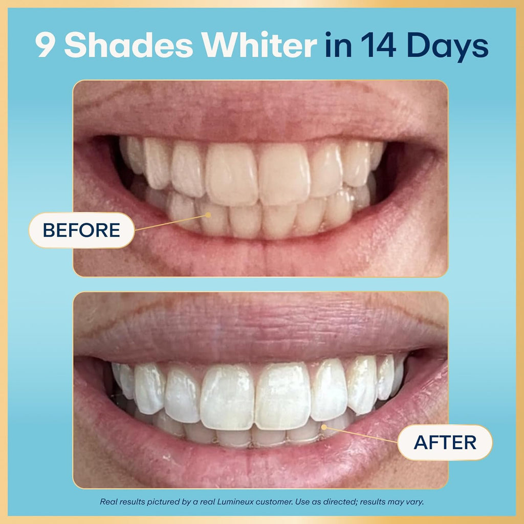 Lumineux Teeth Whitening Strips Kit - 9 Treatments (1 Month) - Peroxide Free
