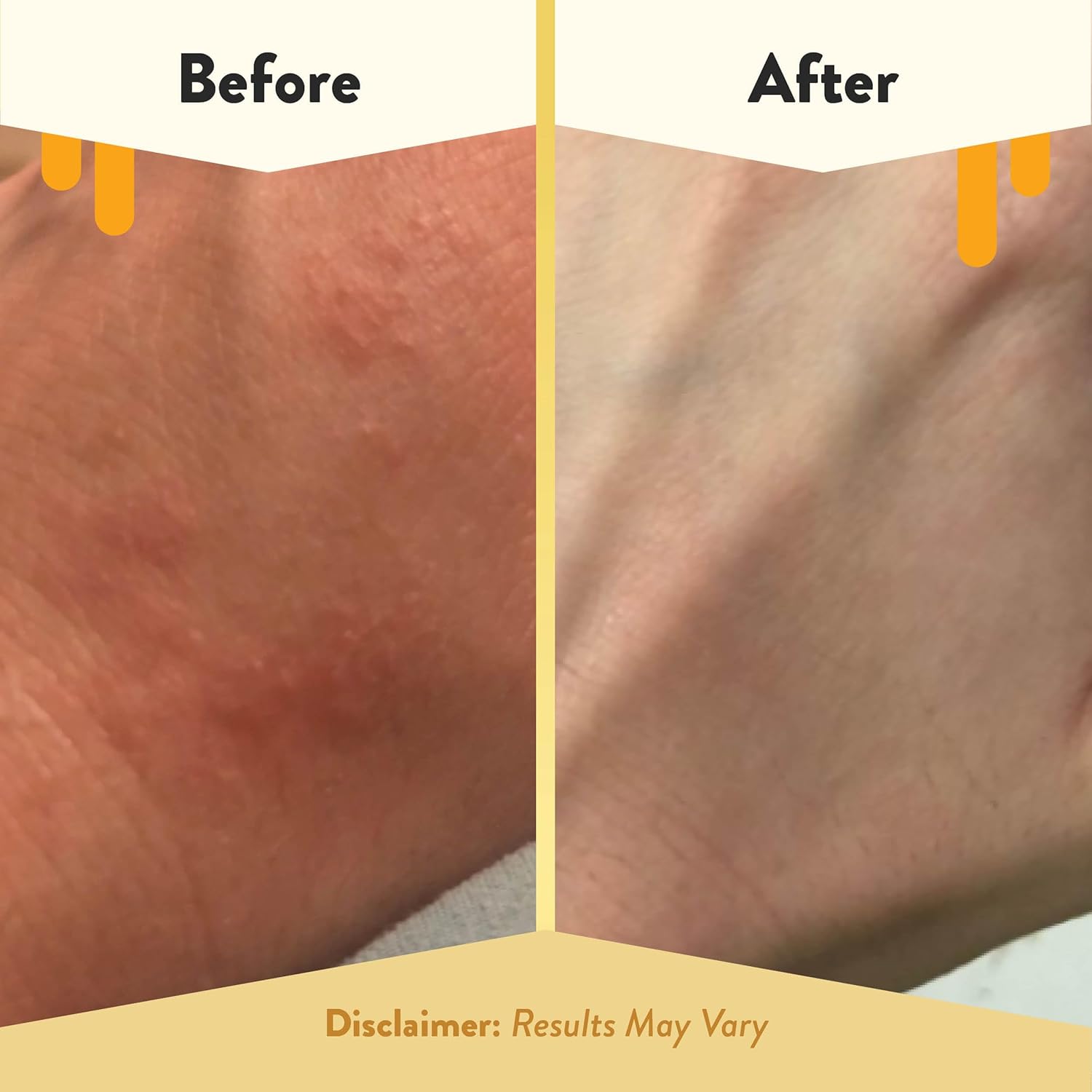 ECZEMA HONEY Oatmeal Body Lotion - Hand & Body Cream for Eczema Relief
